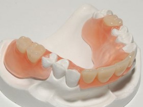 гибкие зубные протезы
